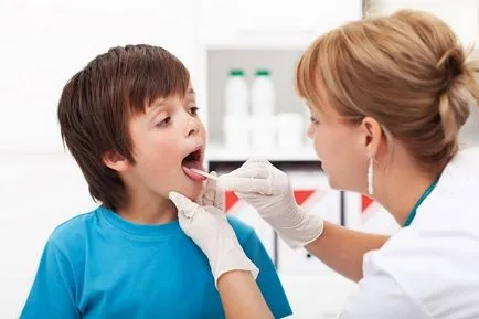 Varicela în gât copilului și adultului, decât să clătiți ca un tratament, erupții Foto - Sănătate Info