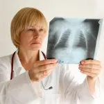 COPD, vagy hogyan nem meghalni köhögés