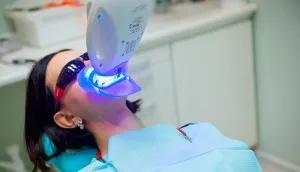 Zoom 3 избелване (фотоизбелващ зъби) ефект, преди и след процедурата,