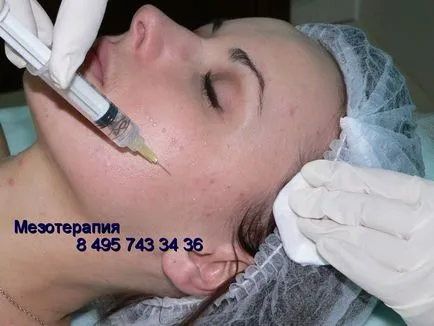 Cum de a reduce sebum cu laser încerca cosmetologie, cosmetologie