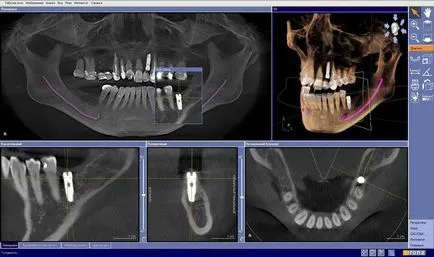 3D CT dinti care prezinta pregatire, pret, fotografie