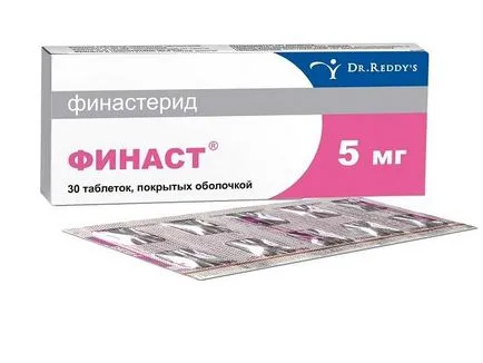 alopeciei androgene la femei, simptomele și cauzele bolii