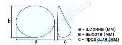 Arion (Arion) - producătorul toracice Bioimplant