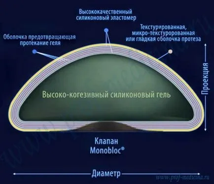 Arion (Arion) - производителят на гръдната Bioimplant