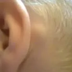 Опасният тумора рекордно ухото на човек да вх лекар за всички заболявания на ушите, носа и гърлото