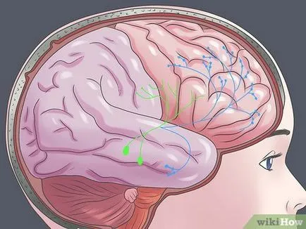 Hogyan lehet megbirkózni a Parkinson-kór