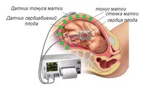 Diagnózis és kezelés méh hypertonus terhesség alatt