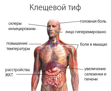 Кърлежи тиф - продължителност на живота, води, лечение, резултати