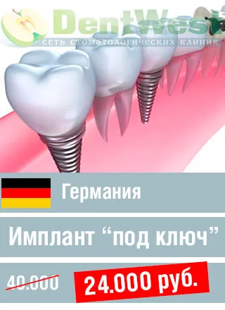 Kapcsolatok hálózat fogászati ​​dentwest