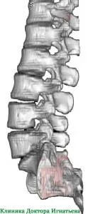 Ridge Tratament (Kiev) »spine❺