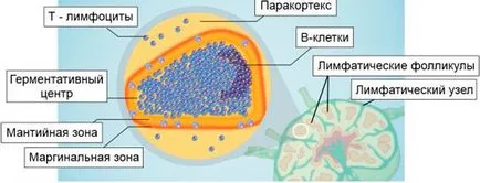 Лимфом на мантията характерни симптоми, лечение