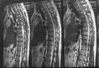 MRI на гръбнака на гръдния кош - цените в Москва намерени 155 цени