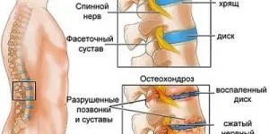 Традиционната медицина - лечение на затлъстяване на черния дроб народни средства