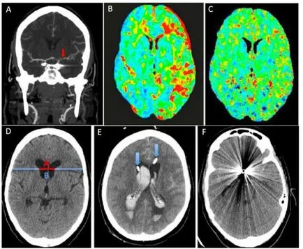 MRI az agy Jekatyerinburgban egészségügyi központok, vélemények