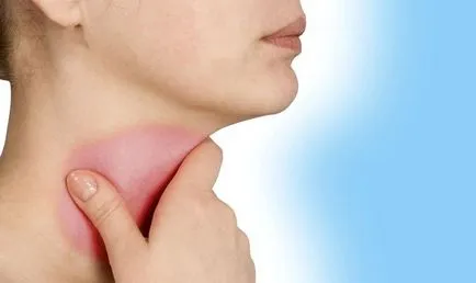гърлото изгори, отколкото да се лекува симптомите - Здравна информация