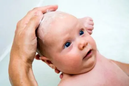 Защо отлепете кожата на новородените и техните родители какво да правят, бебето е здраво!