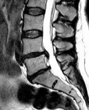 MRI направено в квартал Невски София