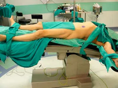 Cicatricile dupa regulile laparoscopice speciale de îngrijire