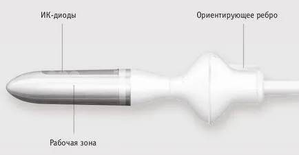 Смарт прост физиотерапия урологичната система