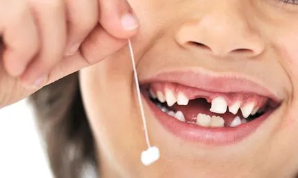 Замяна на зъби при деца схема за постоянна подмяна на мляко