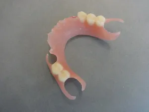 Articolul despre bezmonomerny proteze dentare