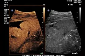 Ultrahang diagnosztika az elit pontossági osztály, Ltd. Medical Center - Hippokratész - cikk