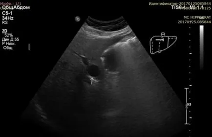 Ultrahang diagnosztika az elit pontossági osztály, Ltd. Medical Center - Hippokratész - cikk