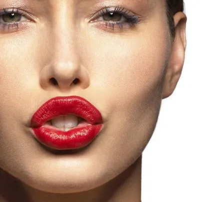 Lip augmentare cu acid hialuronic - Poze inainte si dupa