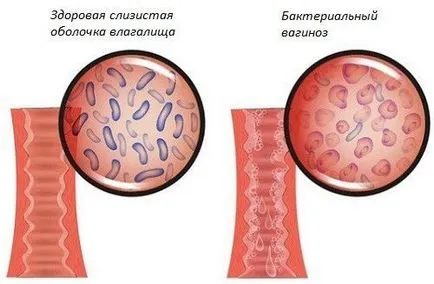 Сълзене освобождаване при жени (като вода) при норма и патология