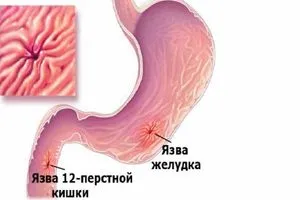 A káros hatás a dohányzás az emberi egészségre