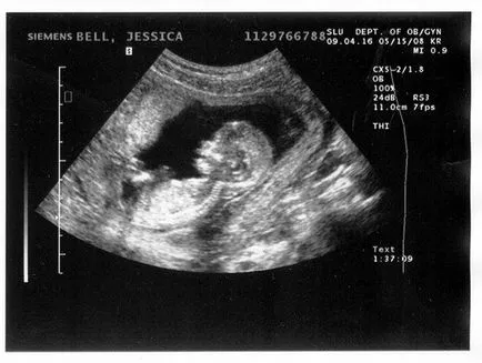 Ártalmas, ha ultrahang terhesség alatt a magzat baba fotó és videó használati