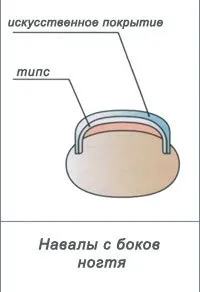 Zapilivanie и полиране ноктопластика