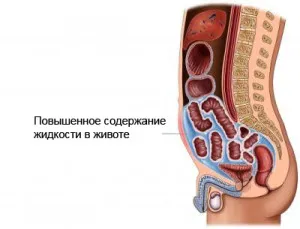 Live sănătos! Noi tratăm dureri de genunchi, timp de 10 minute fără pastile și injecții