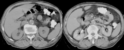 boli complexe radiodiagnostic urogenitale și de sân