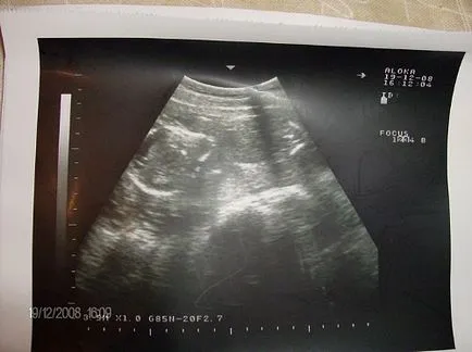 Cand vazut in inima fetale ultrasunete