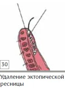 Конюнктивит в Кучета