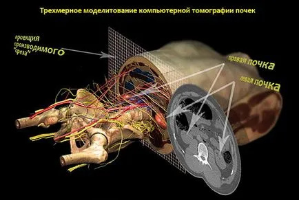 Rm бъбрек - адреси, цени, запис за изследване