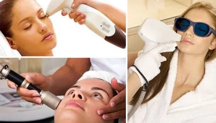 resurfacing laser de îngrijire a pielii feței și după procedura