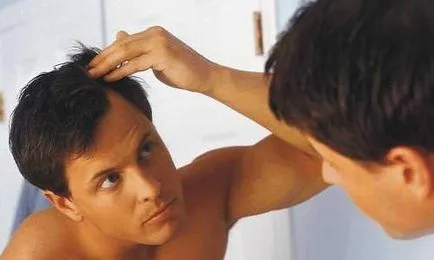 alopecia kezelés gyermekek, nők és férfiak