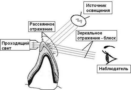 Лекция 4 естетически качества на дентални възстановителни материали 1