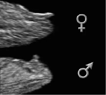 Момче или момиче пола на плода и ултразвук