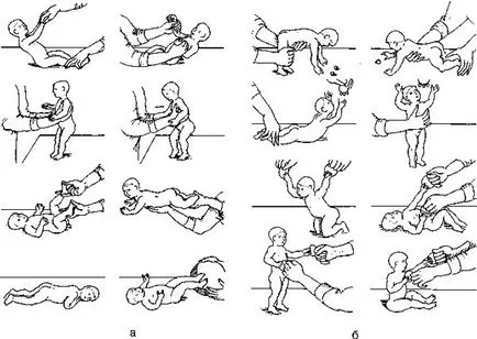 Masaj cu paralizie cerebrală (paralizie cerebrală) - video, de formare, logopedice, adulți,