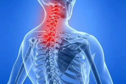 Myositis izmok a nyak és a hát tünetek és a kezelés