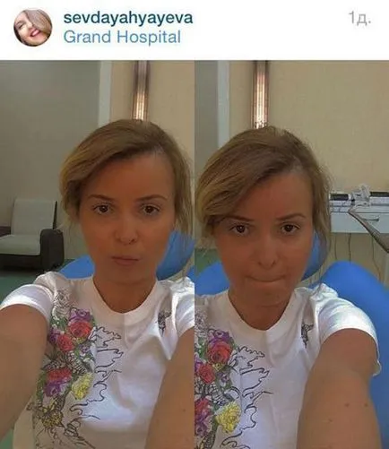 Azerbajdzsán stars without makeup és a Photoshop