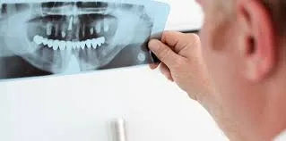 Лицево-челюстна онкология в нашата стоматология в Бутово