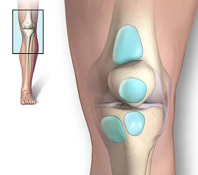 Бурсит на симптомите коляното, причините, видове