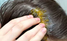 Dimexide haj - használati utasítás, maszkok receptek (a növekedés és a kiesés), értékelés alapján