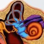 tratamente eficiente pentru sindromul Meniere - un record pentru ORL medicul cu privire la toate bolile ale urechii, nasului și gâtului