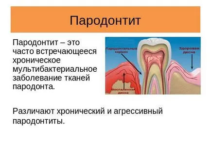 Гел за възпаление на венците при какви са начините да се прилагат