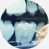 зъбни импланти, стоматологични Ал stomas, София (Сф)
